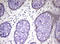 HR1 antibody, LS-C789713, Lifespan Biosciences, Immunohistochemistry paraffin image 