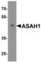 N-Acylsphingosine Amidohydrolase 1 antibody, OAPB00726, Aviva Systems Biology, Western Blot image 