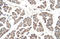 Glutaryl-CoA Dehydrogenase antibody, ARP43559_T100, Aviva Systems Biology, Immunohistochemistry paraffin image 