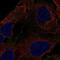 DENN Domain Containing 3 antibody, NBP2-55190, Novus Biologicals, Immunofluorescence image 