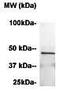 CD192 antibody, TA354812, Origene, Western Blot image 
