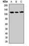 Ubiquitin Specific Peptidase 5 antibody, orb412252, Biorbyt, Western Blot image 