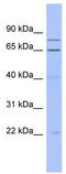 Zinc Finger Protein 431 antibody, TA345494, Origene, Western Blot image 