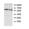 Calcium/Calmodulin Dependent Protein Kinase Kinase 2 antibody, orb47964, Biorbyt, Western Blot image 