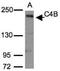Complement Component 4B (Chido Blood Group), Copy 2 antibody, NBP1-31229, Novus Biologicals, Western Blot image 