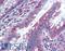 Mucin 13, Cell Surface Associated antibody, LS-B6120, Lifespan Biosciences, Immunohistochemistry paraffin image 