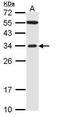 F-Box Protein 2 antibody, TA308339, Origene, Western Blot image 