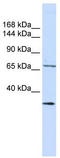 Semaphorin-6D antibody, TA338445, Origene, Western Blot image 
