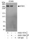 Inositol 1,4,5-Trisphosphate Receptor Type 1 antibody, A302-157A, Bethyl Labs, Immunoprecipitation image 