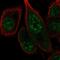 FA Complementation Group M antibody, NBP2-55444, Novus Biologicals, Immunocytochemistry image 