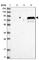 SOGA Family Member 3 antibody, HPA035389, Atlas Antibodies, Western Blot image 