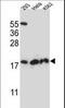 Dihydrofolate Reductase 2 antibody, LS-C167391, Lifespan Biosciences, Western Blot image 
