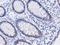 Dipeptidyl Peptidase 3 antibody, LS-C786269, Lifespan Biosciences, Immunohistochemistry paraffin image 