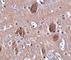 Cell Death Inducing P53 Target 1 antibody, NBP1-76996, Novus Biologicals, Immunohistochemistry frozen image 