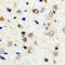 Serine/threonine-protein kinase PAK 3 antibody, LS-C368453, Lifespan Biosciences, Immunohistochemistry paraffin image 