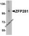 Zinc Finger Protein 281 antibody, 6233, ProSci, Western Blot image 