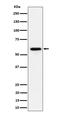 Pre-MRNA Processing Factor 31 antibody, M03137, Boster Biological Technology, Western Blot image 