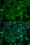 Rac Family Small GTPase 1 antibody, orb373713, Biorbyt, Immunofluorescence image 