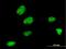Zinc Finger Protein 131 antibody, H00007690-M07, Novus Biologicals, Immunofluorescence image 