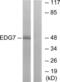 Lpa3 antibody, LS-C120647, Lifespan Biosciences, Western Blot image 