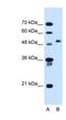 Collagen alpha-2(VI) chain antibody, NBP1-54614, Novus Biologicals, Western Blot image 
