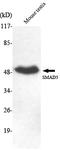 SMAD Family Member 5 antibody, STJ98549, St John