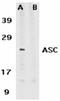PYD And CARD Domain Containing antibody, ADI-905-173-100, Enzo Life Sciences, Western Blot image 