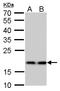 Ribosomal Protein S15 antibody, GTX101839, GeneTex, Western Blot image 