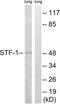 Nuclear Receptor Subfamily 5 Group A Member 1 antibody, LS-C118374, Lifespan Biosciences, Western Blot image 