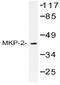 Dual Specificity Phosphatase 4 antibody, AP20437PU-N, Origene, Western Blot image 