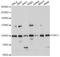 Origin Recognition Complex Subunit 1 antibody, A14756, ABclonal Technology, Western Blot image 