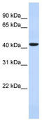 Kim1 antibody, TA341901, Origene, Western Blot image 