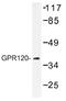 Free fatty acid receptor 4 antibody, AP01302PU-N, Origene, Western Blot image 