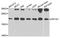 Eukaryotic Translation Initiation Factor 1A Y-Linked antibody, A4270, ABclonal Technology, Western Blot image 