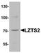 Leucine Zipper Tumor Suppressor 2 antibody, TA320050, Origene, Western Blot image 