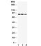MEFV Innate Immuity Regulator, Pyrin antibody, R31814, NSJ Bioreagents, Western Blot image 