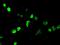 Neurogenin 1 antibody, MA5-24899, Invitrogen Antibodies, Immunocytochemistry image 