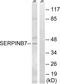 SERPINB7 antibody, LS-C120382, Lifespan Biosciences, Western Blot image 