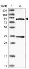 Pantothenate Kinase 4 antibody, NBP1-83832, Novus Biologicals, Western Blot image 