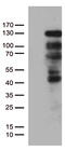 Progesterone Receptor antibody, CF802712, Origene, Western Blot image 