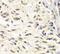 Checkpoint Kinase 1 antibody, FNab01652, FineTest, Immunohistochemistry paraffin image 