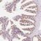 Homeobox protein Hox-B13 antibody, NBP2-48778, Novus Biologicals, Immunohistochemistry frozen image 
