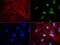 PBX Homeobox 1 antibody, LS-C796761, Lifespan Biosciences, Immunofluorescence image 