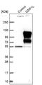 DAZ Interacting Zinc Finger Protein 1 Like antibody, NBP1-84030, Novus Biologicals, Western Blot image 