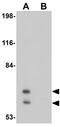 Phosphatidylinositol-binding clathrin assembly protein antibody, GTX85213, GeneTex, Western Blot image 