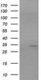 Retinoic Acid Receptor Responder 1 antibody, TA506082, Origene, Western Blot image 