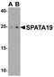 Spermatogenesis Associated 19 antibody, PA5-72740, Invitrogen Antibodies, Western Blot image 