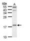 Ubiquitin-conjugating enzyme E2 D1 antibody, GTX109257, GeneTex, Western Blot image 