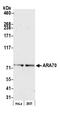Nuclear receptor coactivator 4 antibody, A302-272A, Bethyl Labs, Western Blot image 