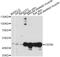Corneodesmosin antibody, LS-C749601, Lifespan Biosciences, Western Blot image 